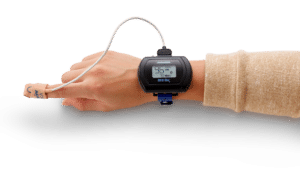 Nonin WristOx2 Model 3150 Wrist-Worn Pulse Oximeter